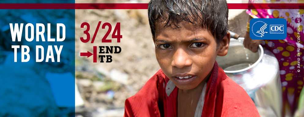 World TB Day 2017