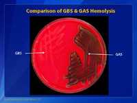 Comparison of GBS & GAS Hemolysis