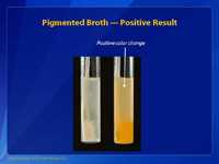 Pigmented Broth — Positive Result