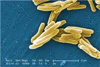 Mycobacterium tuberculosis