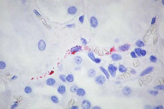 immunostaining of renal interstitial capillaries using Peromyscus serum