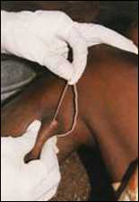 Guinea worm extraction