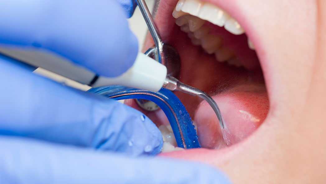 	Photo of medical water use in a dental office