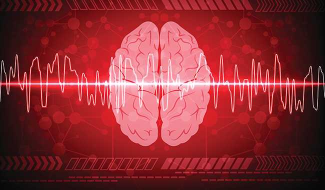 Stroke Vital Signs