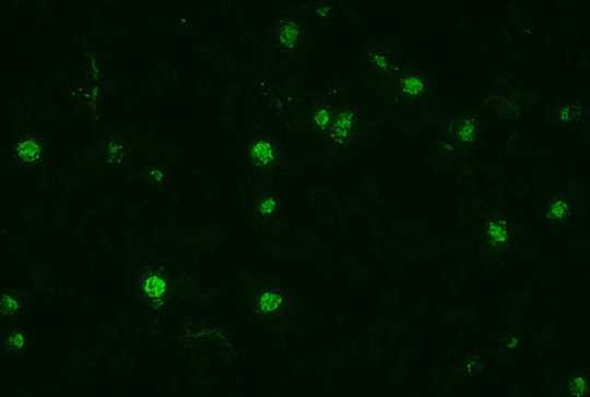 Photomicrograph, showing a dark background against which stand out, fluorescing, approximately 10 parasites of Plasmodium falciparum .