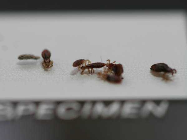 The lice were obtained from patients presenting to a local emergency department as part of an investigation of Bartonella endocarditis cases, and were quite still by the time the photograph was taken, in our laboratory with an improvised support. The photo shows several lice from the same patient which were later tested for Bartonella quintana.