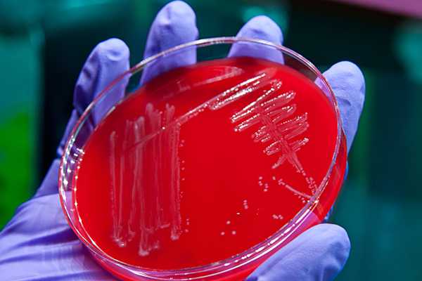 A pure culture of the bacteria that made someone sick.