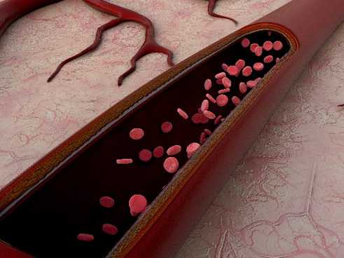 Hereditary Hemorrhagic Telangiectasia