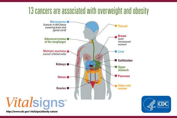 An illustration of a human body with organs showing, and labels naming different types of cancer pointing to those organs.