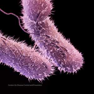 Medical illustration of non-typhoidal Salmonella.