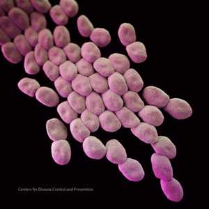 Medical illustration of Acinetobacter