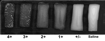 Figure 7 is a picture showing the rating the intensity of the agglutination reaction according to the density of the cell suspension.