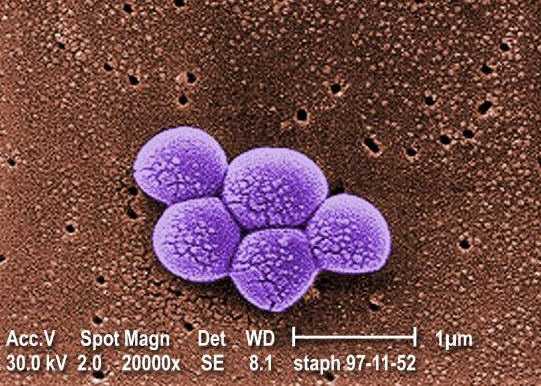 MRSA Bacteriae