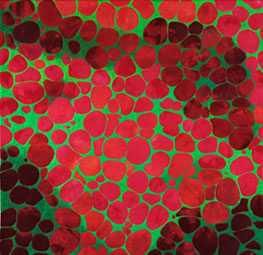 Photo: Virginia Abrams, Lipid Cells, 2009.