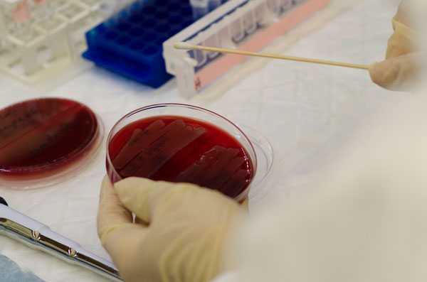 Camper collects samples to use in Pulsed-field gel electrophoresis (PFGE) lab.