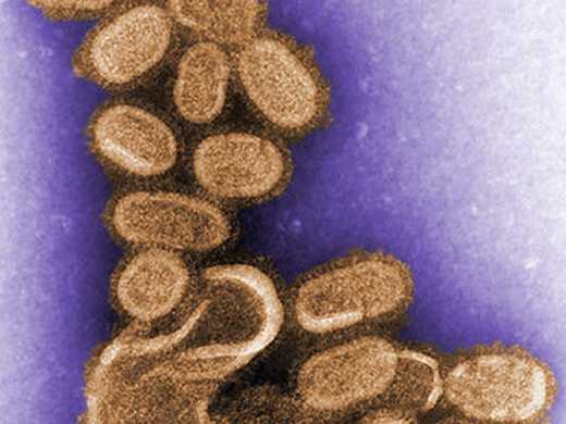 Wonder at the complexity of the transmission electron microscope that CDC scientists used to study hantavirus, avian influenza, and West Nile virus.