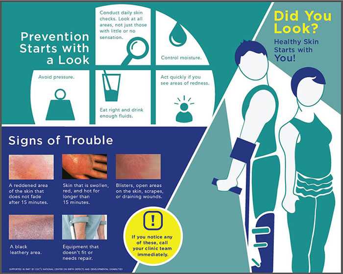 Infographic with tips to prevent skin irratiation. Did you look? Healthy skin starts with you. 