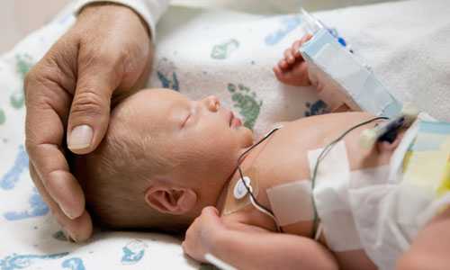 Infant on its back being monitored.