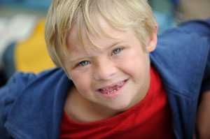 Boy with missing teeth smiling