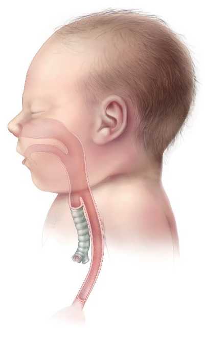 Normal esophagus