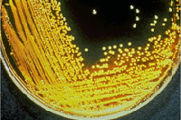 vibrio cholerae growing on thiosulphate cibrate bile salt sucrose (TCB) agar plates