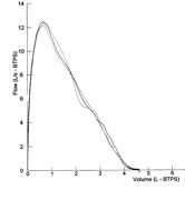 	Spirometry flow volume curve chart