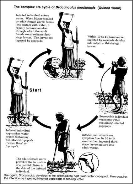 Image shows the complex chain of Guinea worm infection.