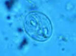 a Giardia cyst