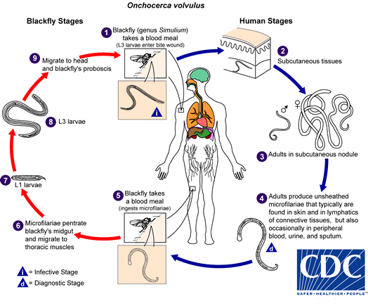 Onchocerciasis lifecycle