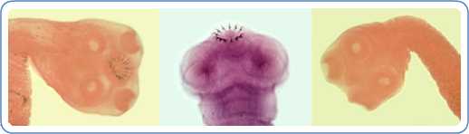 L&C: Scoleces of T. solium. Note the four large suckers and rostellum containing two rows of hooks. R: Scolex of T. saginata. Note the four large suckers and lack of rostellum and rostellar hooks.