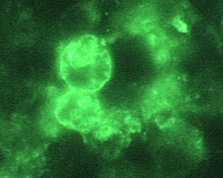 Indirect Immunofluorescence (IIF) assay for Naegleria fowleri, 1000x oil magnification