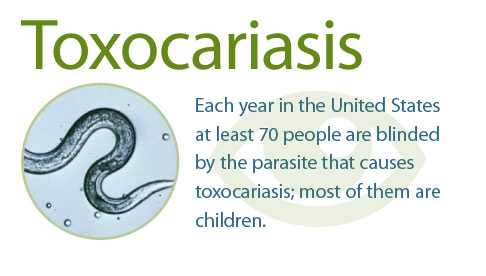 Toxocariasis