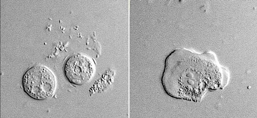 Left, Sappinia cysts. Right, a Sappinia trophozoite.