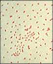 A photomicrograph of Bordetella (Haemophilus) pertussis bacteria using Gram stain technique.