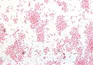 Gram stain of Bordetella pertussis