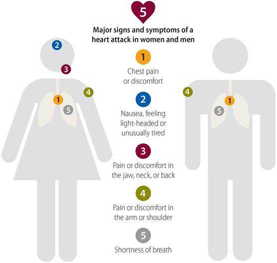 Signs Symptoms of Heart Attack