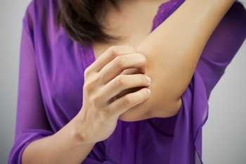 image of a woman scratching her elbow