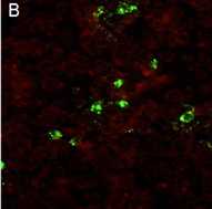 microscopic image of rabies virus