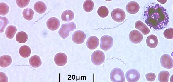 Tick-borne Relapsing Fever spirochetes