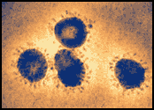 Image of the SARS Coronavirus