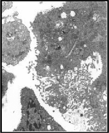 Image of the SARS Coronavirus