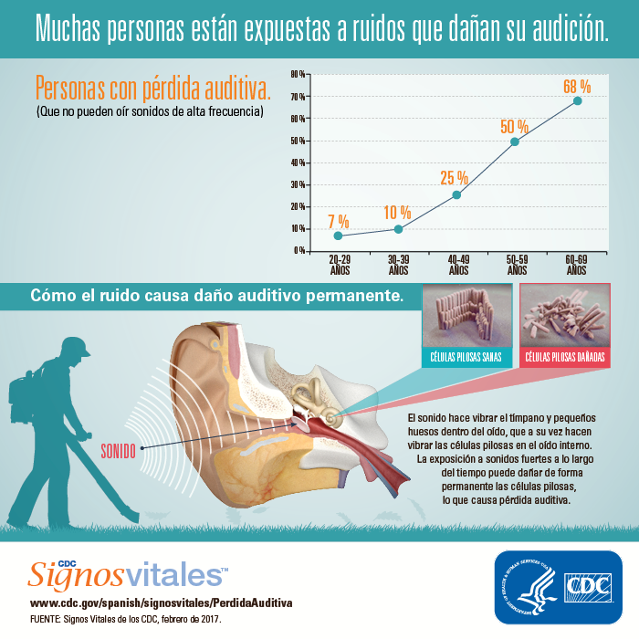 Infografía: Muchas personas están expuestas a ruidos que dañan su audición.