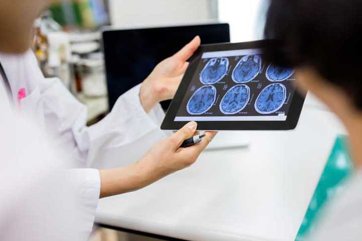 Personal médico revisando imágenes cerebrales en una radiografía