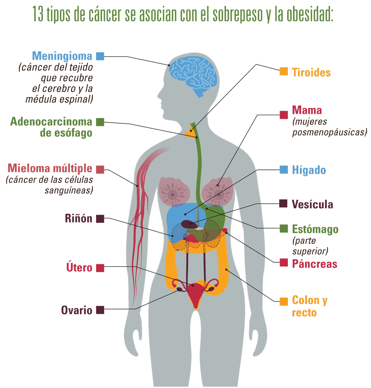 Infografía: 13 tipos de cáncer se asocian con el sobrepeso y la obesidad.