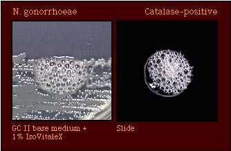 catalase