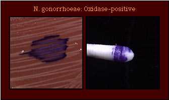 oxidase