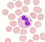 A granulocyte on a peripheral blood smear