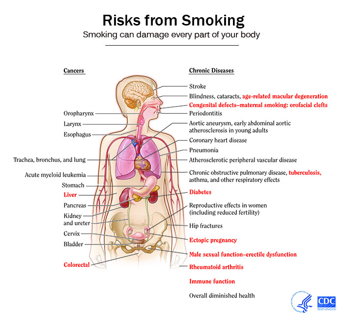 Smoking Can Damage Every Part of the Body.