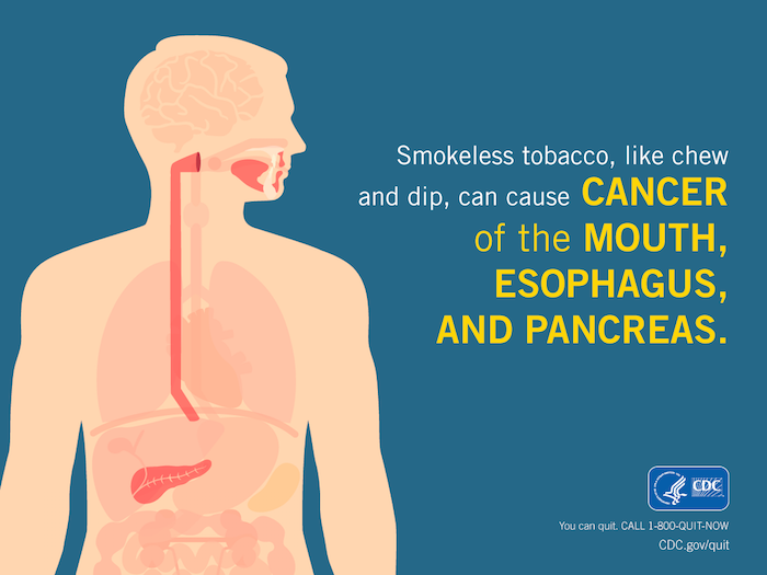 Image of a body in silhouette with text: Smokeless tobacco, like chew and dip, can cause cancer of the mouth, esophagus, and pancreas.