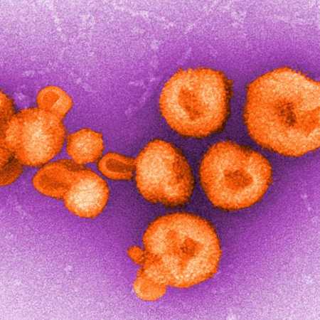 Transmission electron micrograph depicting eight viral particles of a virus belonging to the Arenavirus genus.